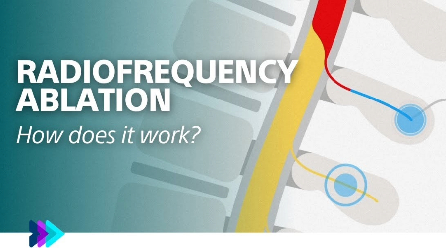 Video, das die Funktionsweise der RFA erklärt